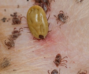 how do you treat a tick infestation on a dog